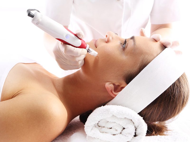 What to expect from a Micro-needling treatment