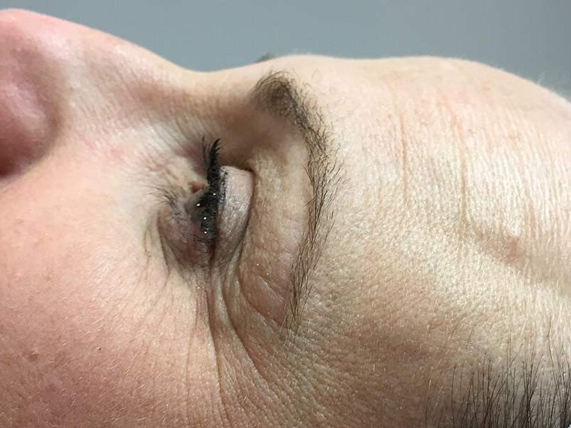 What are the best treatments to help dehydrated skin?
