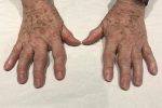 Ageing Hand Treatments London