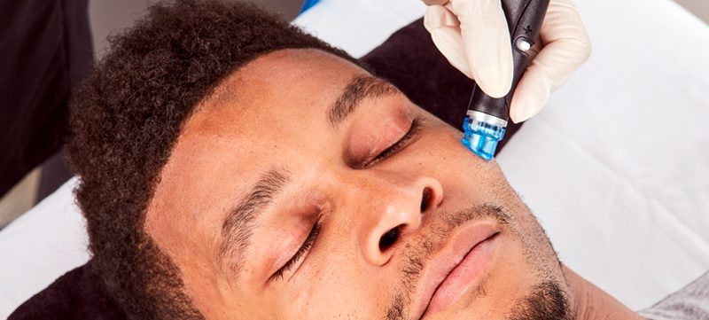 Male hydrafacials London