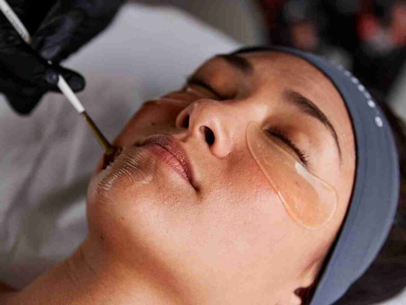 alumier skin peel Wimbledon & Kensington Dull Skin