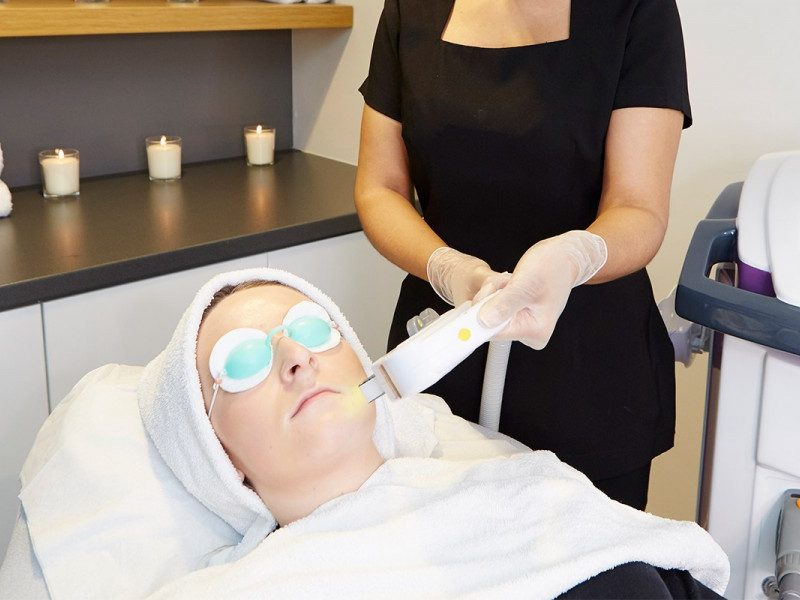 IPL Skin Rejuvenation: What Is It and How Does It Work?