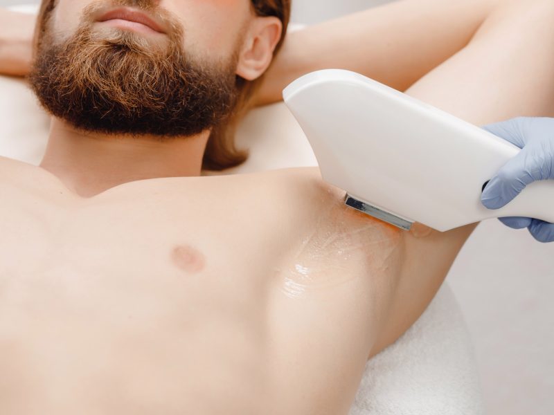 The Rise of Cosmetic Treatments for Men
