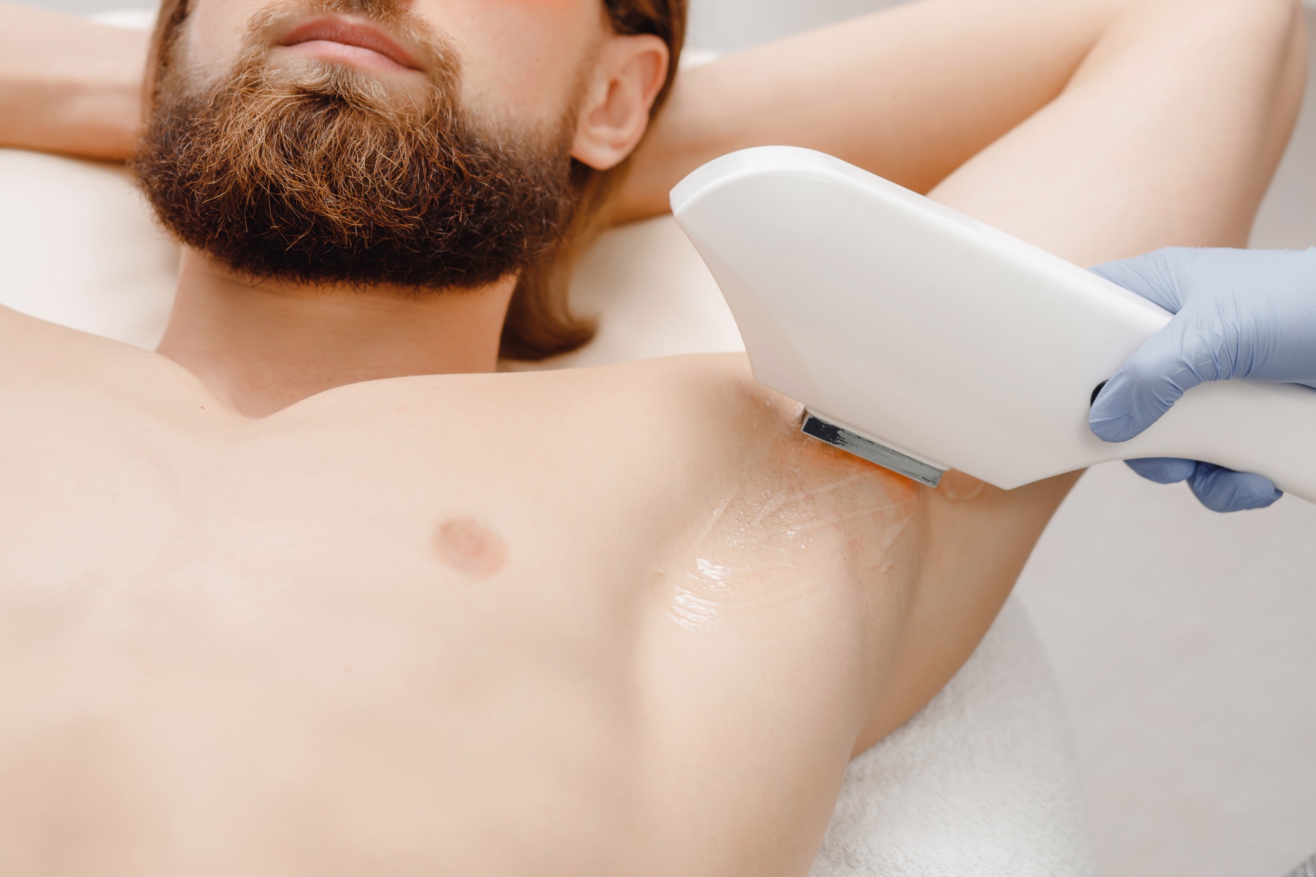 Is Laser Hair Removal Effective For Men?