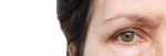 drooping eyelid treatment Kensington