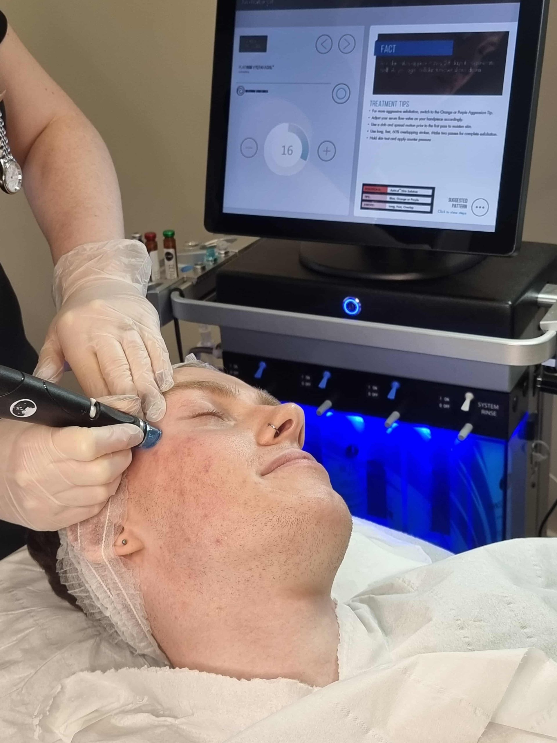 Hydrafacial London