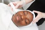 Venus Freeze kensington & wimbledon Eyebag treatments