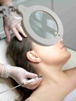 advanced electrolysis treatments Wimbledon & Kensington closed comedones