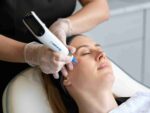 Dermapen micro-needling Wimbledon & Kensington Dehyrdrated Skin