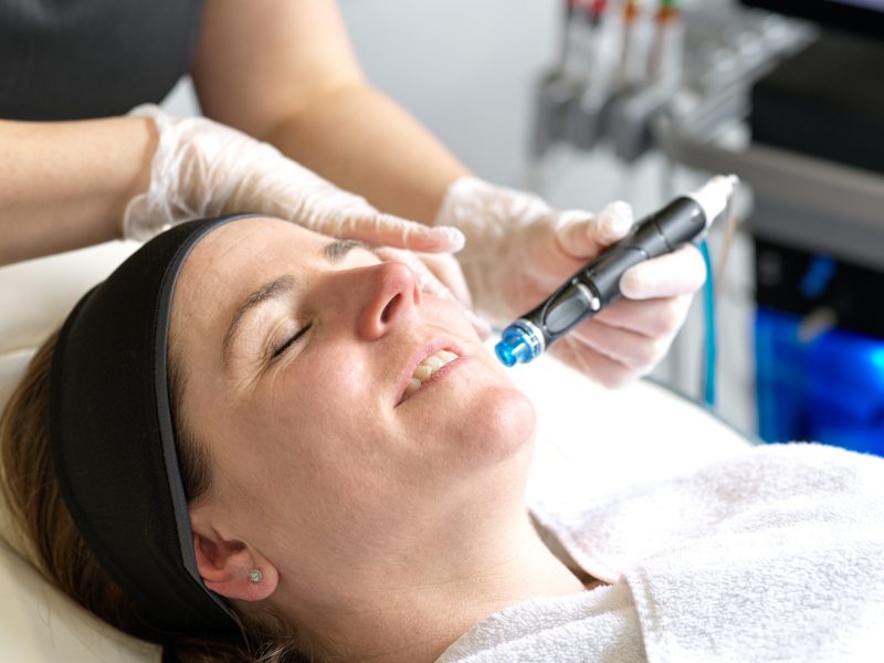 hydrafacial treatments near me Wimbledon & Kensington eye bags