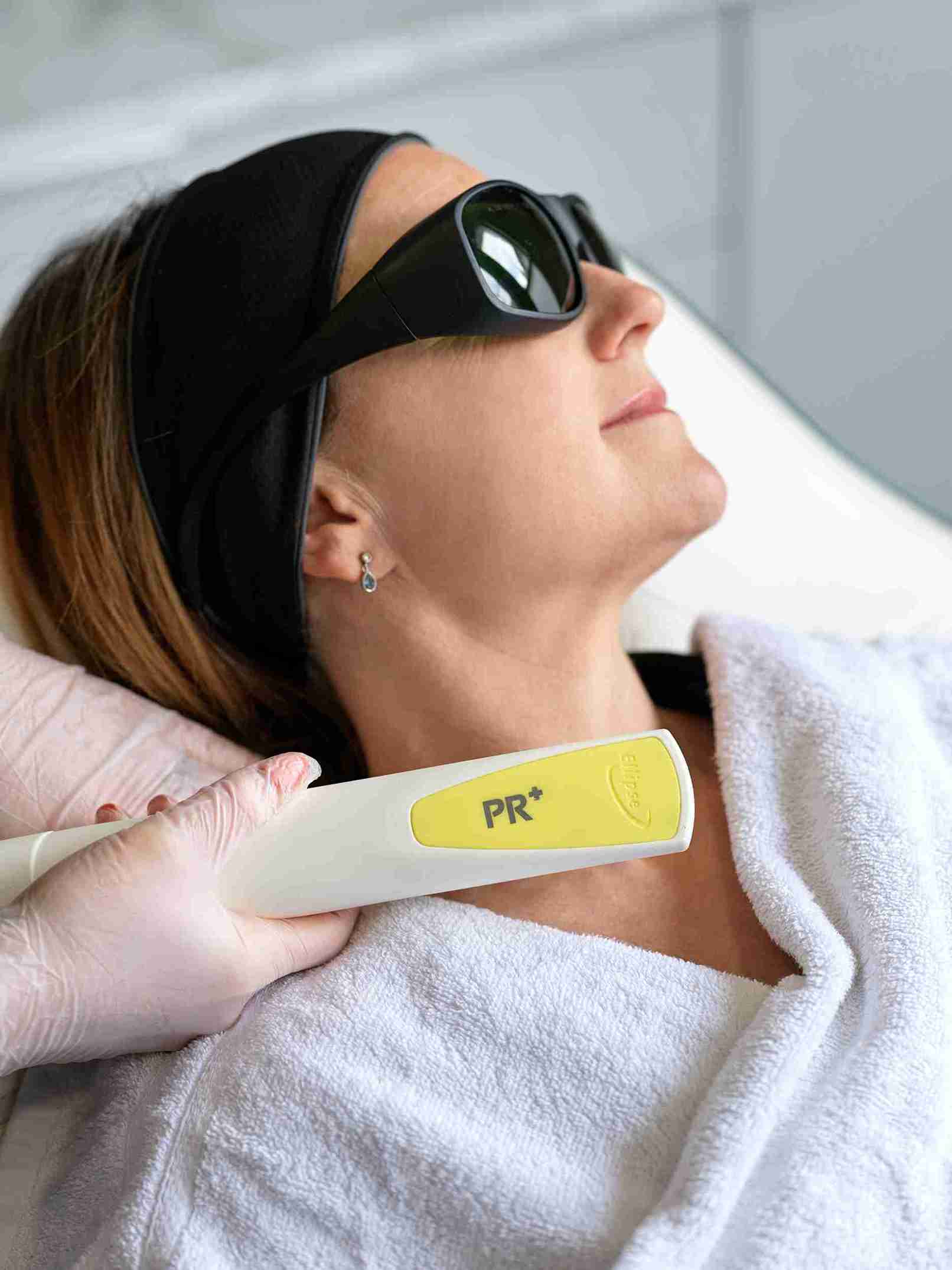 thread vein treatments london