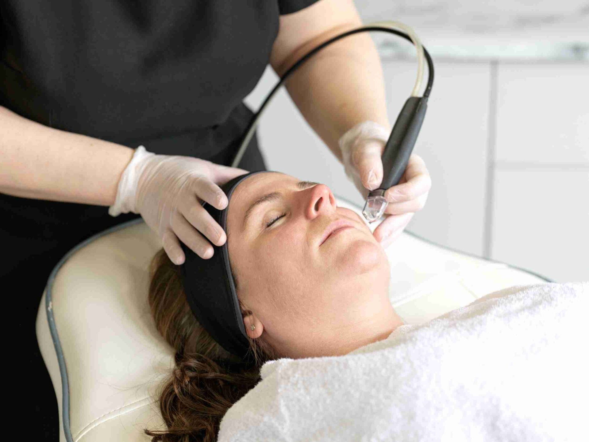 Microdermabrasion Wimbledon Kensington Microdermabrasion London
