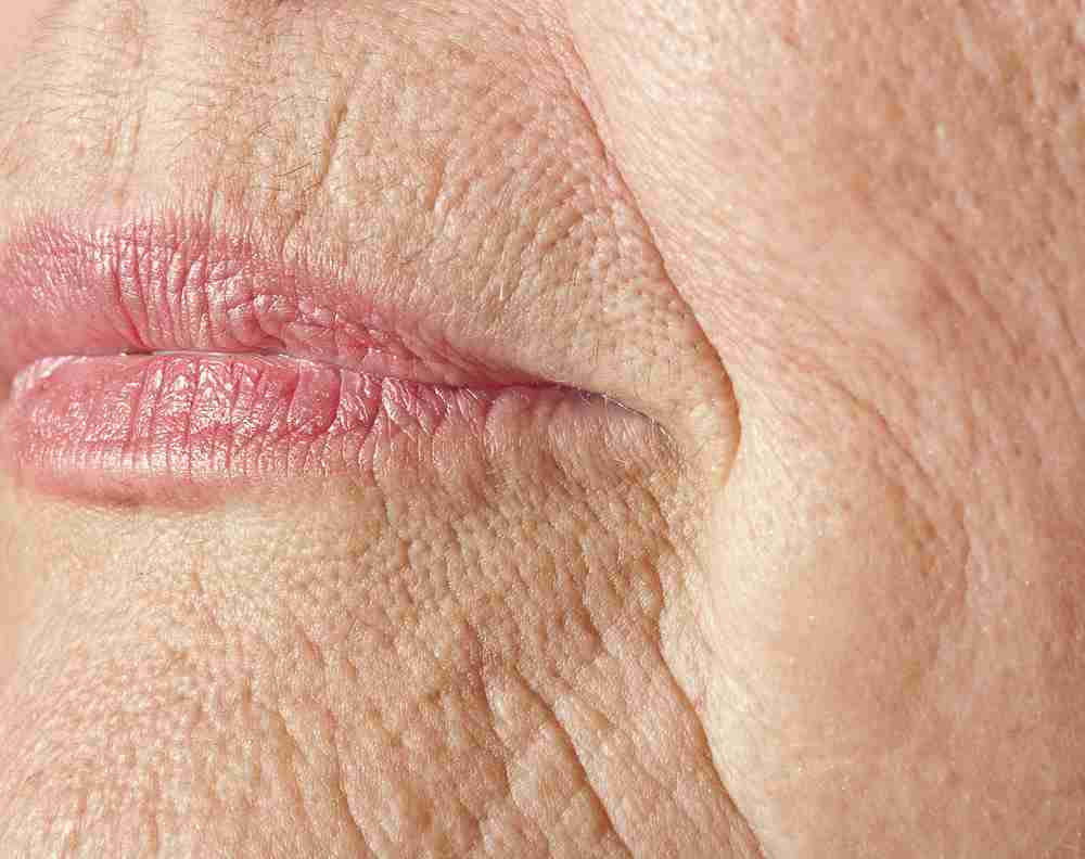 ageing skin treatments london