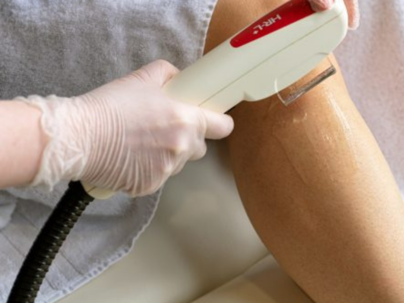 Laser Hair Removal: Stages of Hair Growth