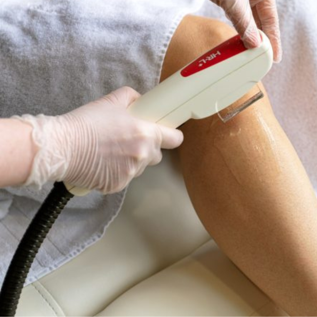 IPL Laser Hair Removal  Hair Removal Wimbledon & Kensington