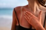 Our Recommended Treatments for Sun Damage