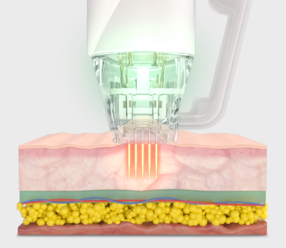 Focus Dual Treatment London