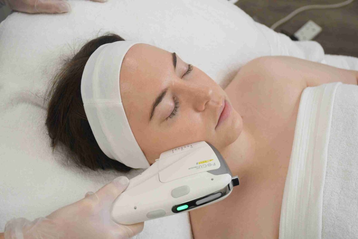 HIFU facial London