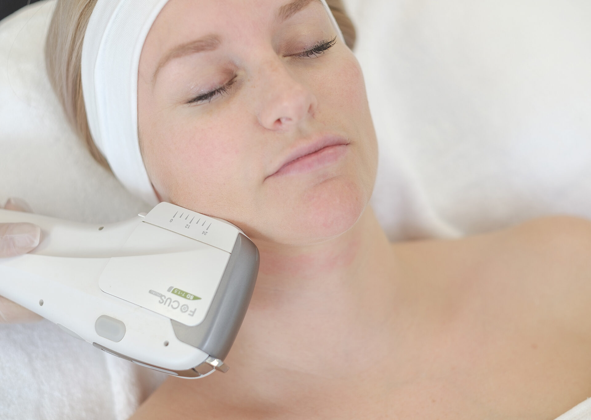 HIFU facial treatment