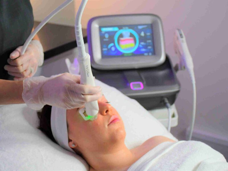 RF Microneedling vs. Microneedling: Which Treatment is Right for You?