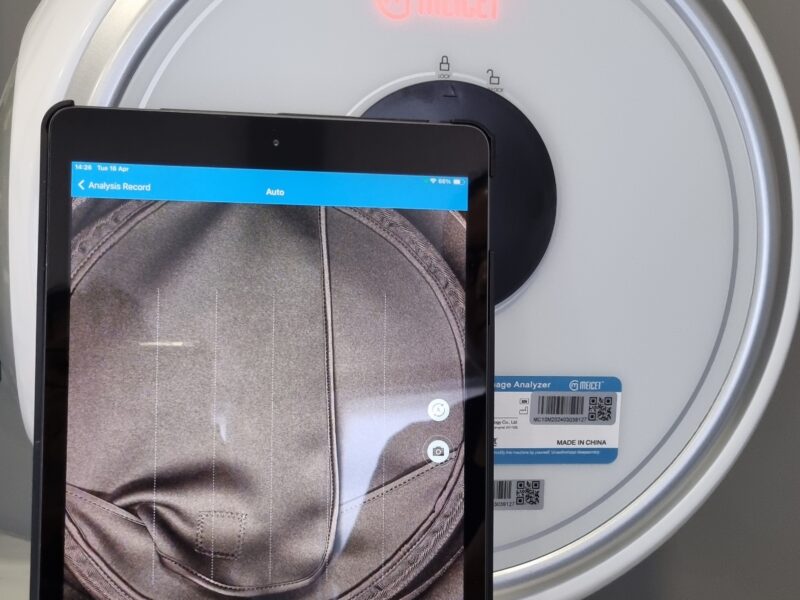 The Benefits of a Skin Analysis before Choosing a Treatment