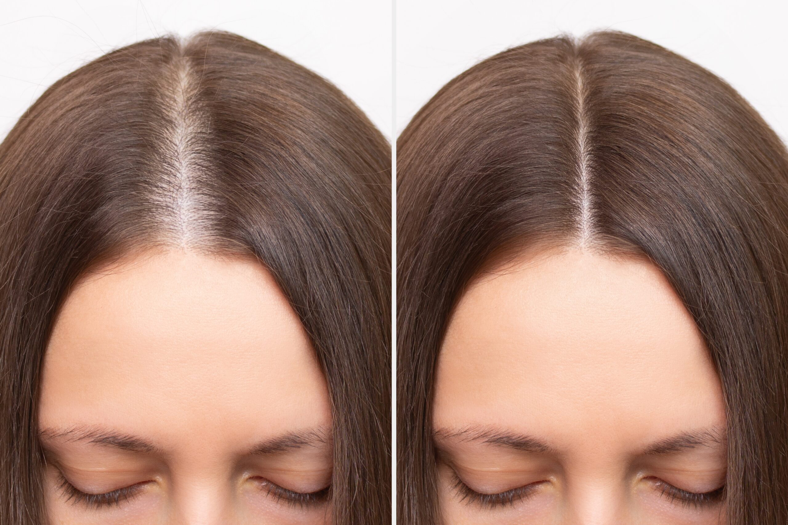 hydrafacial keravive hair treatment london