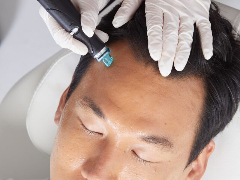 Does Kerarive help with Hair Thinning & Hair Loss?