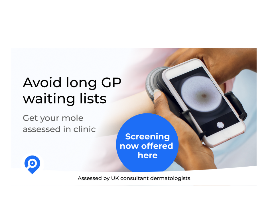 mole mapping Wimbledon and Kensington