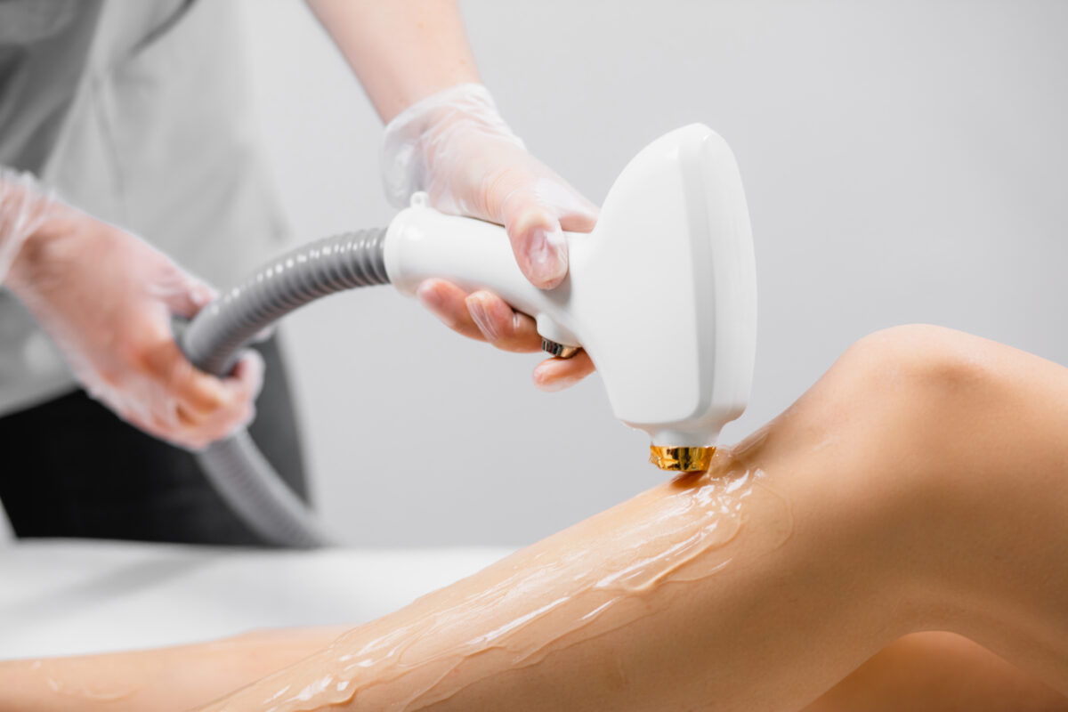 IPL Hair Removal