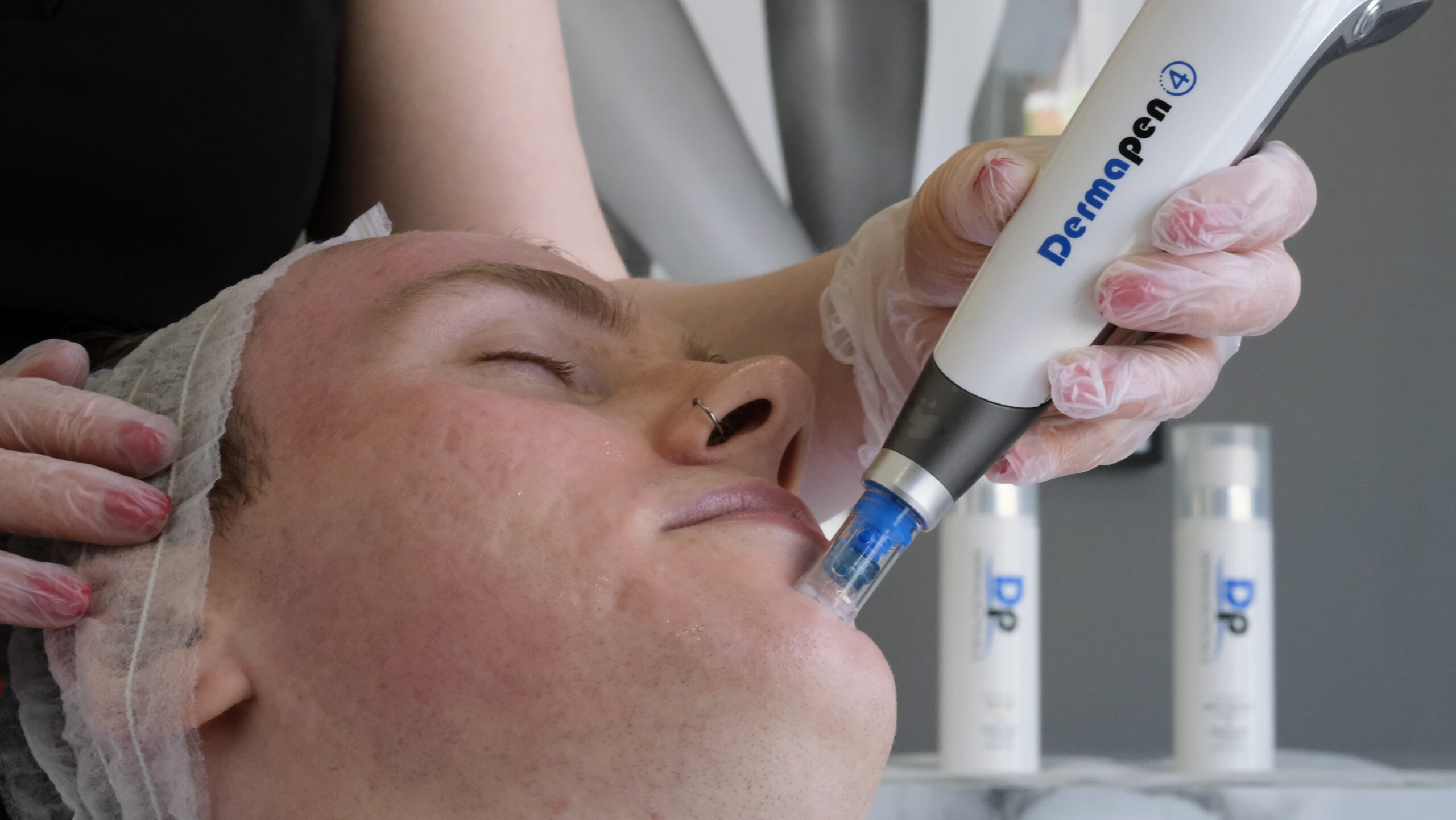 polynucleotide treatment central london