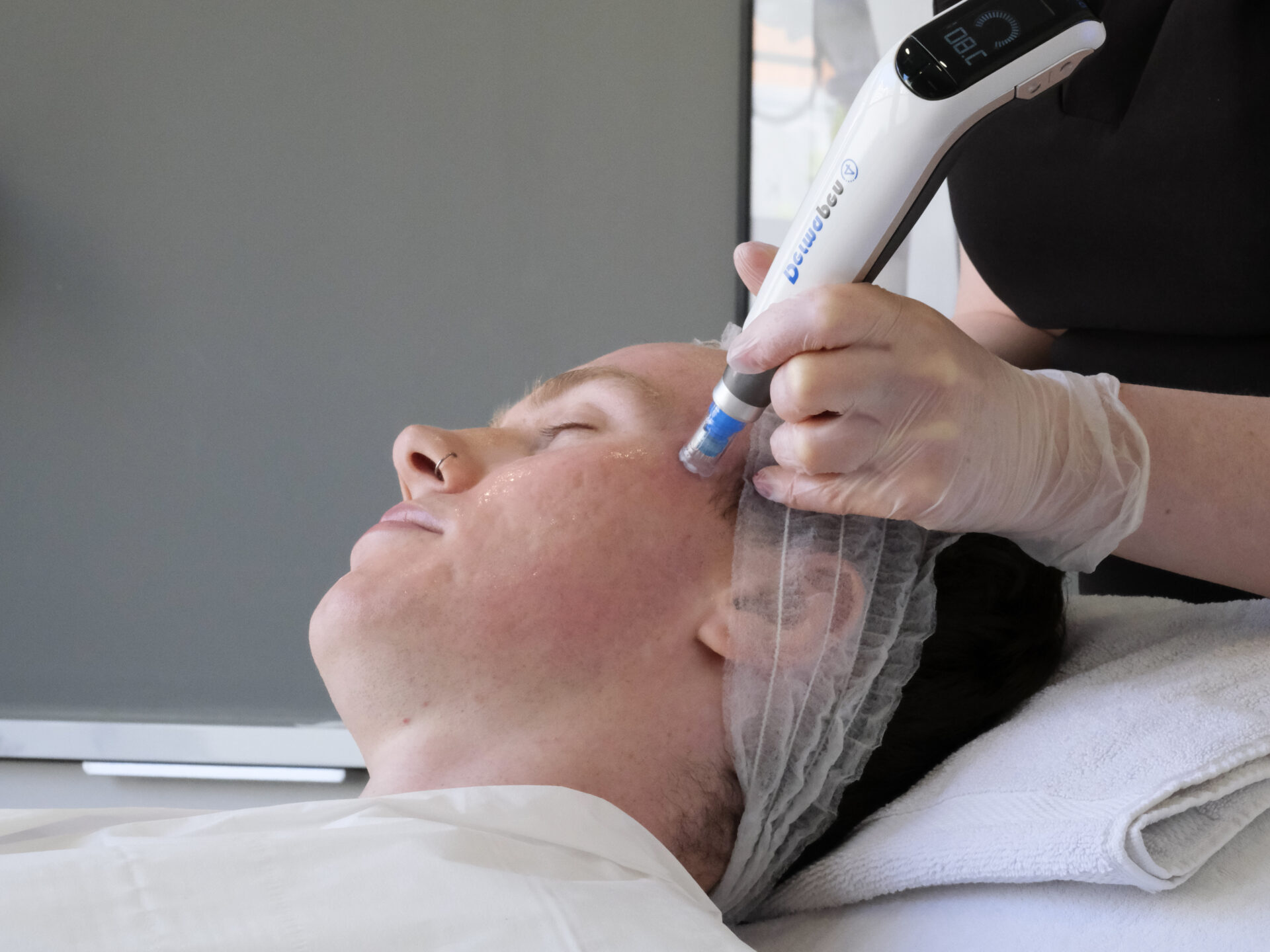 Skin rejuvenation treatment