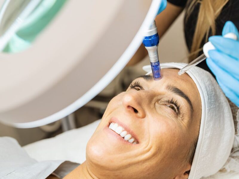 PDRN Treatment