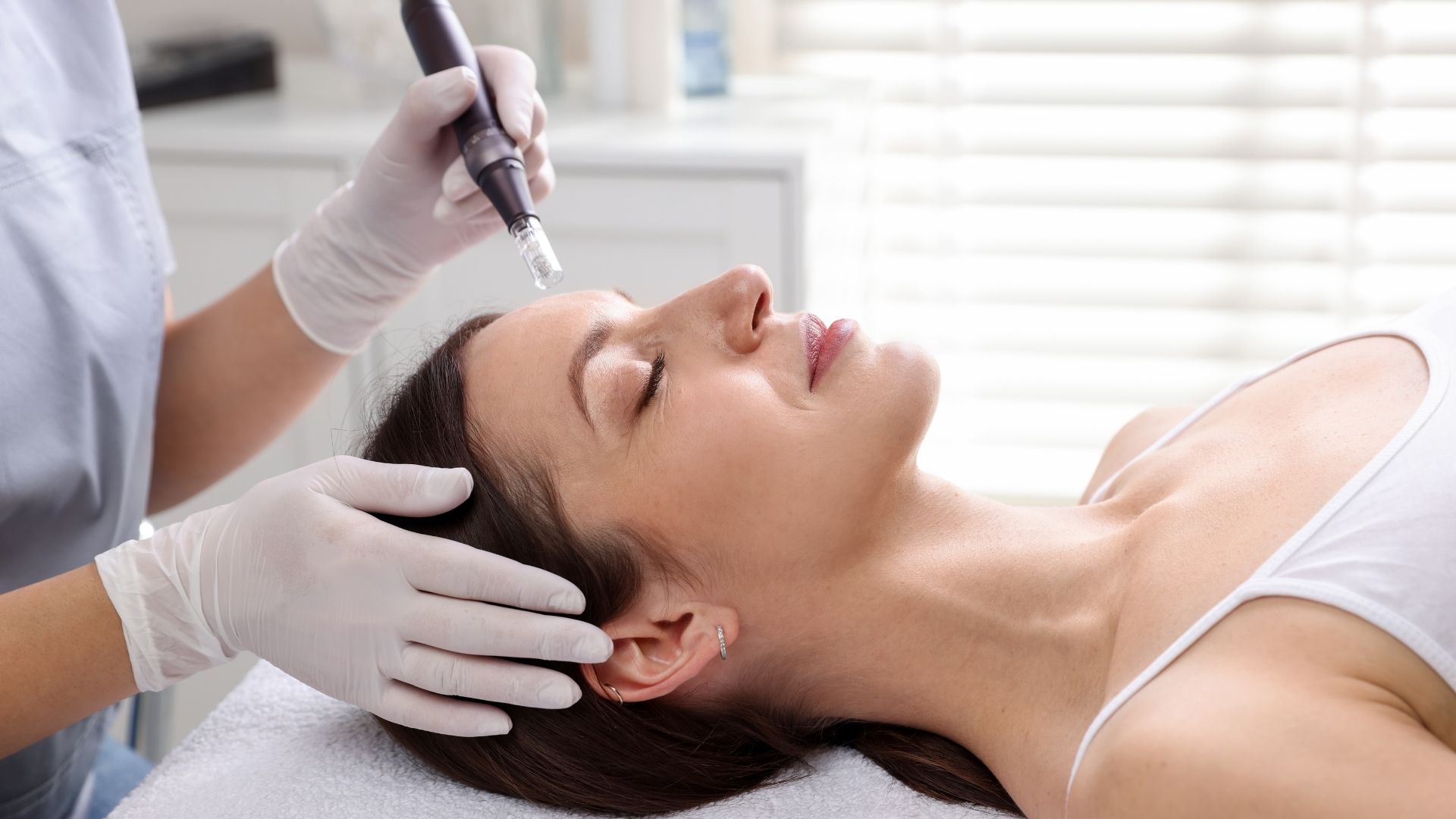 Micro Needling Treatments in Raynes Park