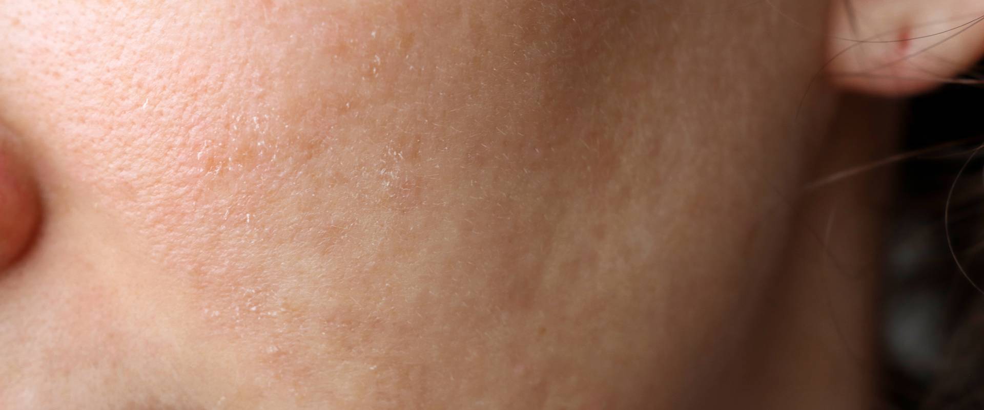 Understanding AlumierMD Treatments In Acton