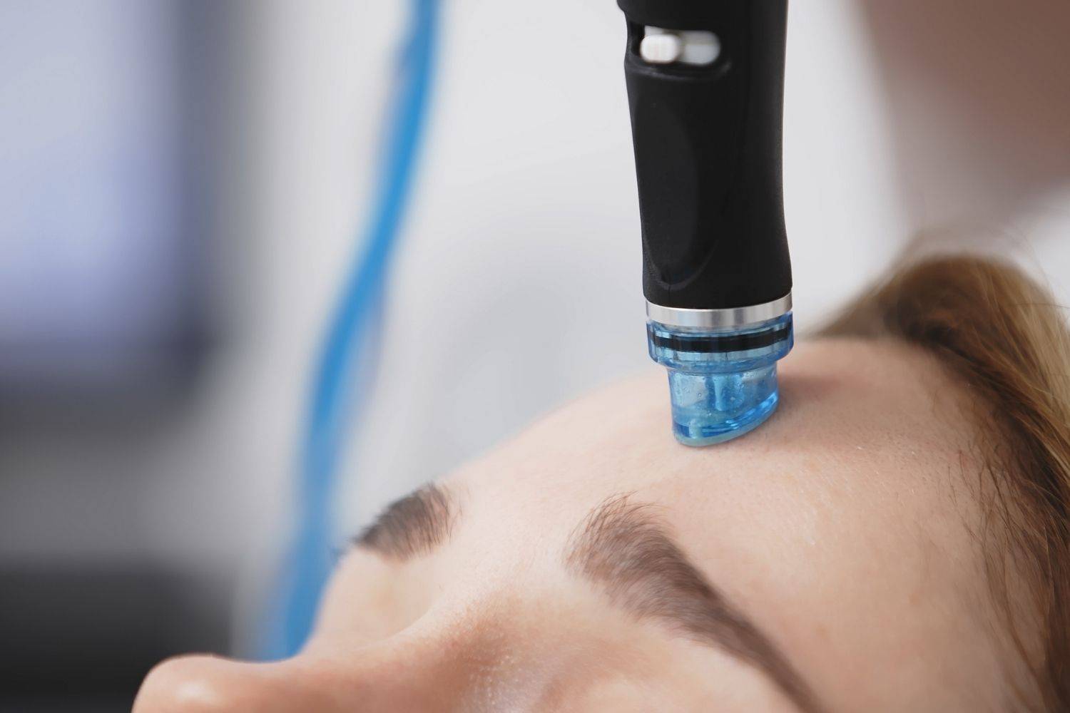 Your Skincare Companion: Hydrofacial At Eden Skin Clinic, Acton