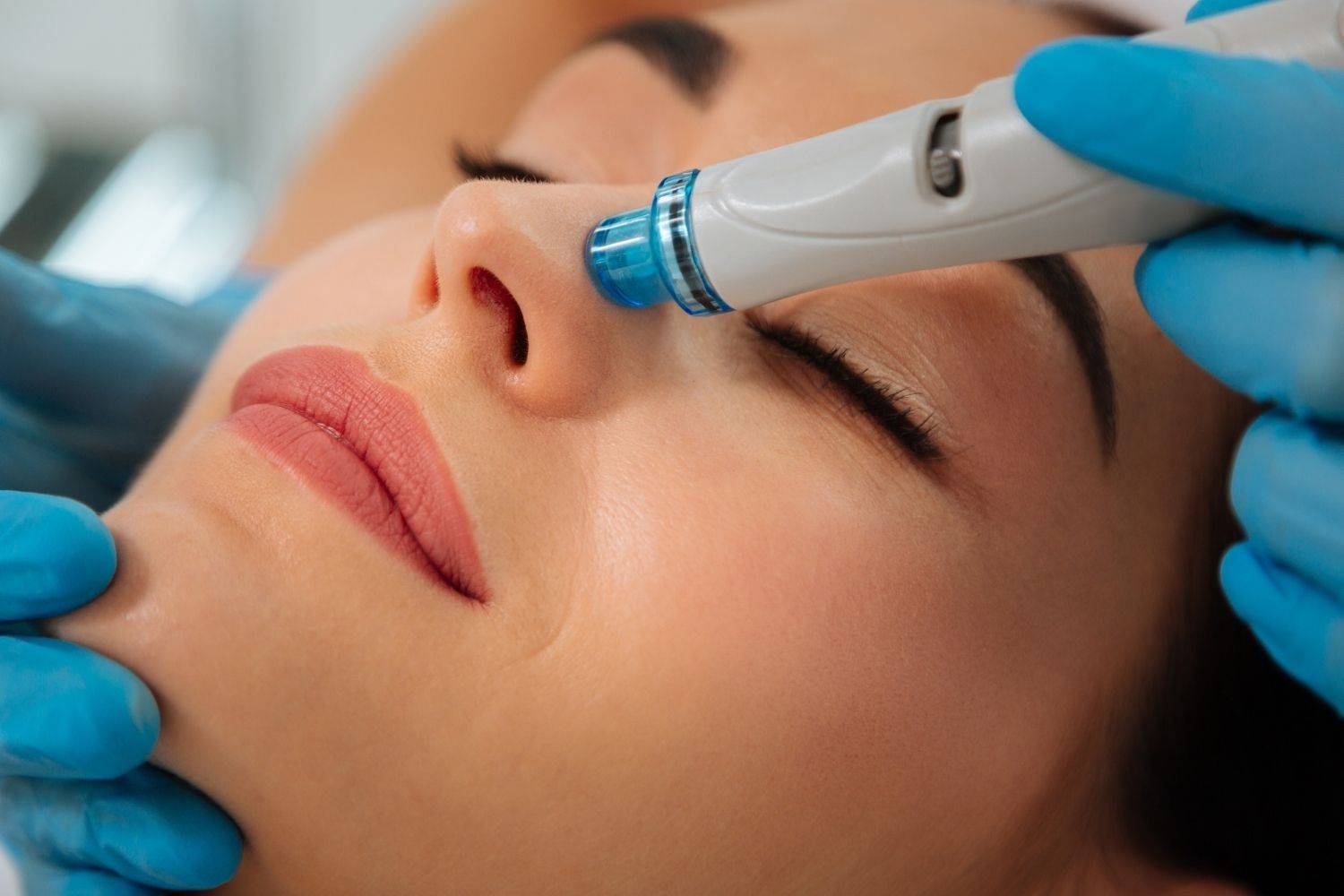 Step Into The Future Of Skincare With Hydrofacial In Acton