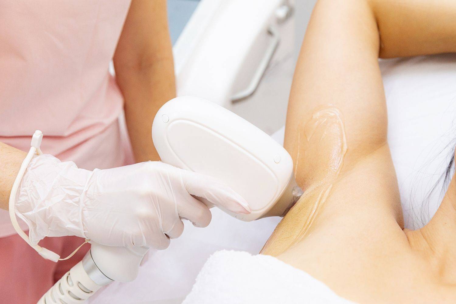 The IPL Laser Hair Reduction Process In Wimbledon