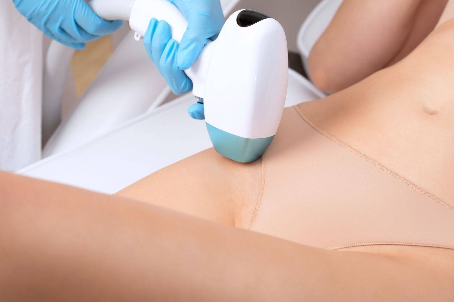 Advantages Of Choosing IPL Laser Hair Reduction At Wimbledon
