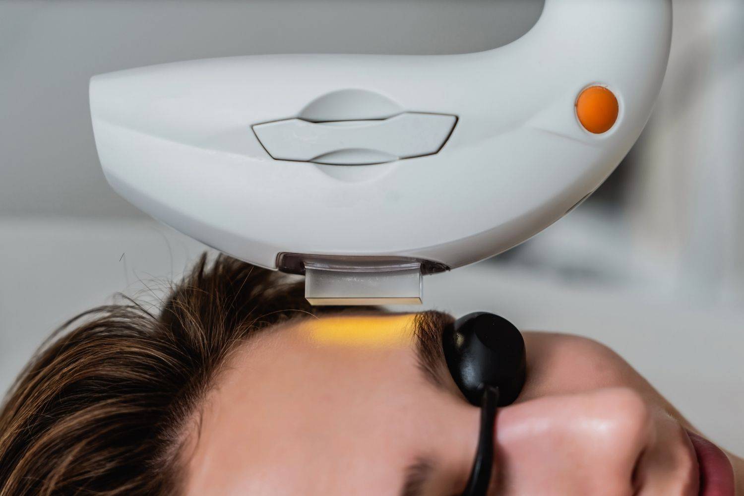 Why Choose Eden Skin Clinic For IPL Treatments?