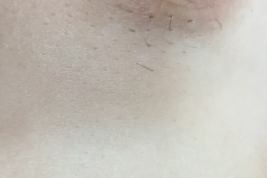 Nipple Hair Nipple Hair