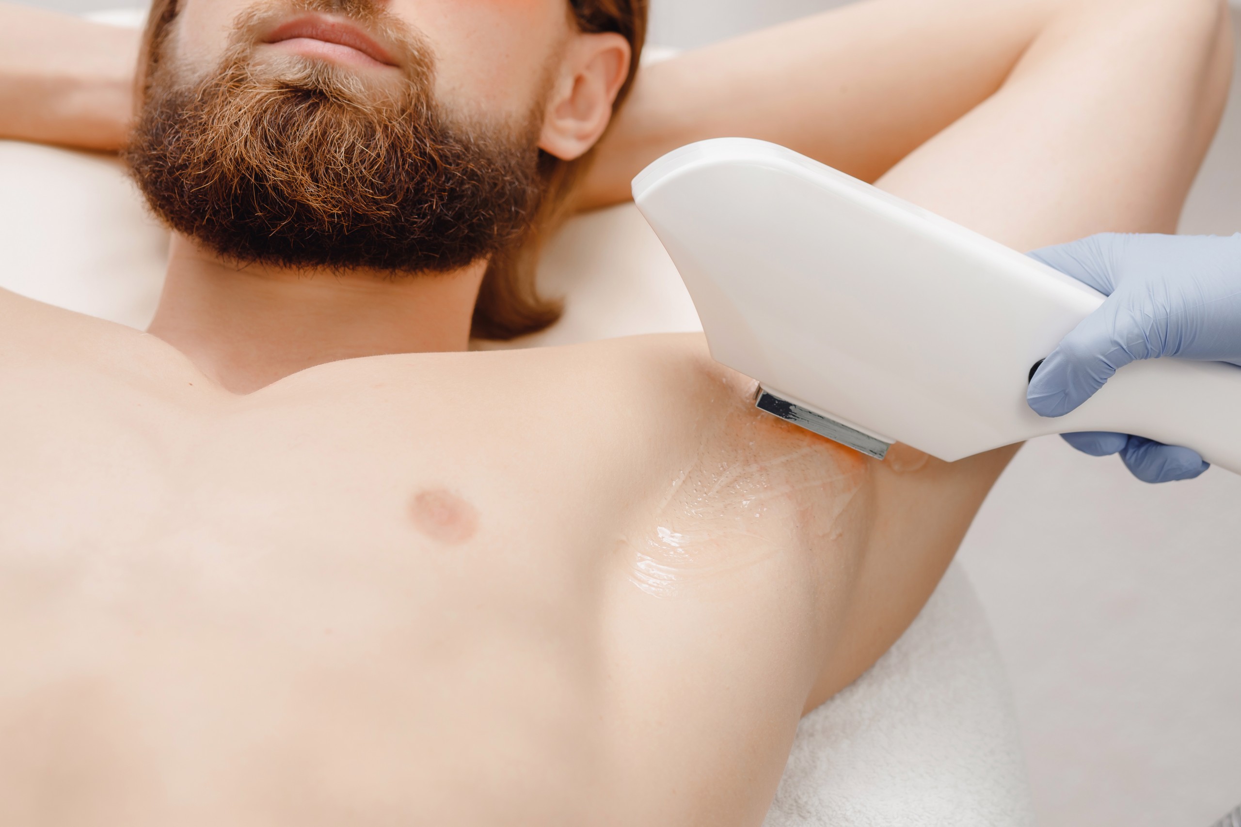 Is Laser Hair Removal Effective For Men? Is Laser Hair Removal Effective For Men?