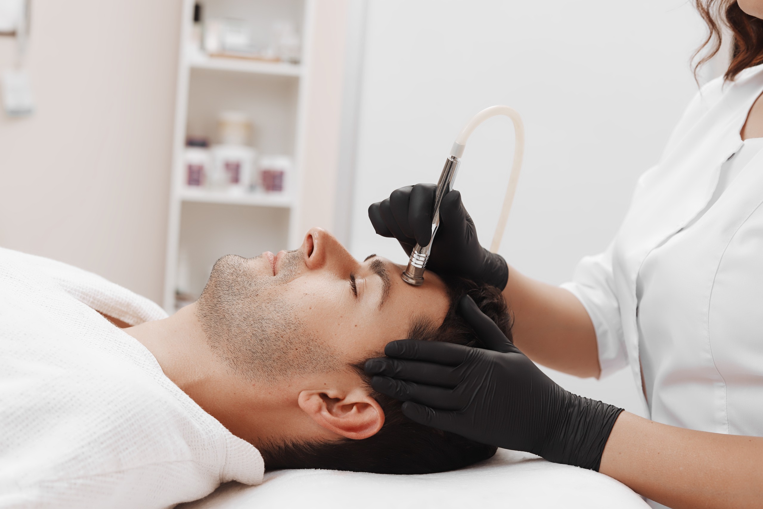 microdermabrasion London